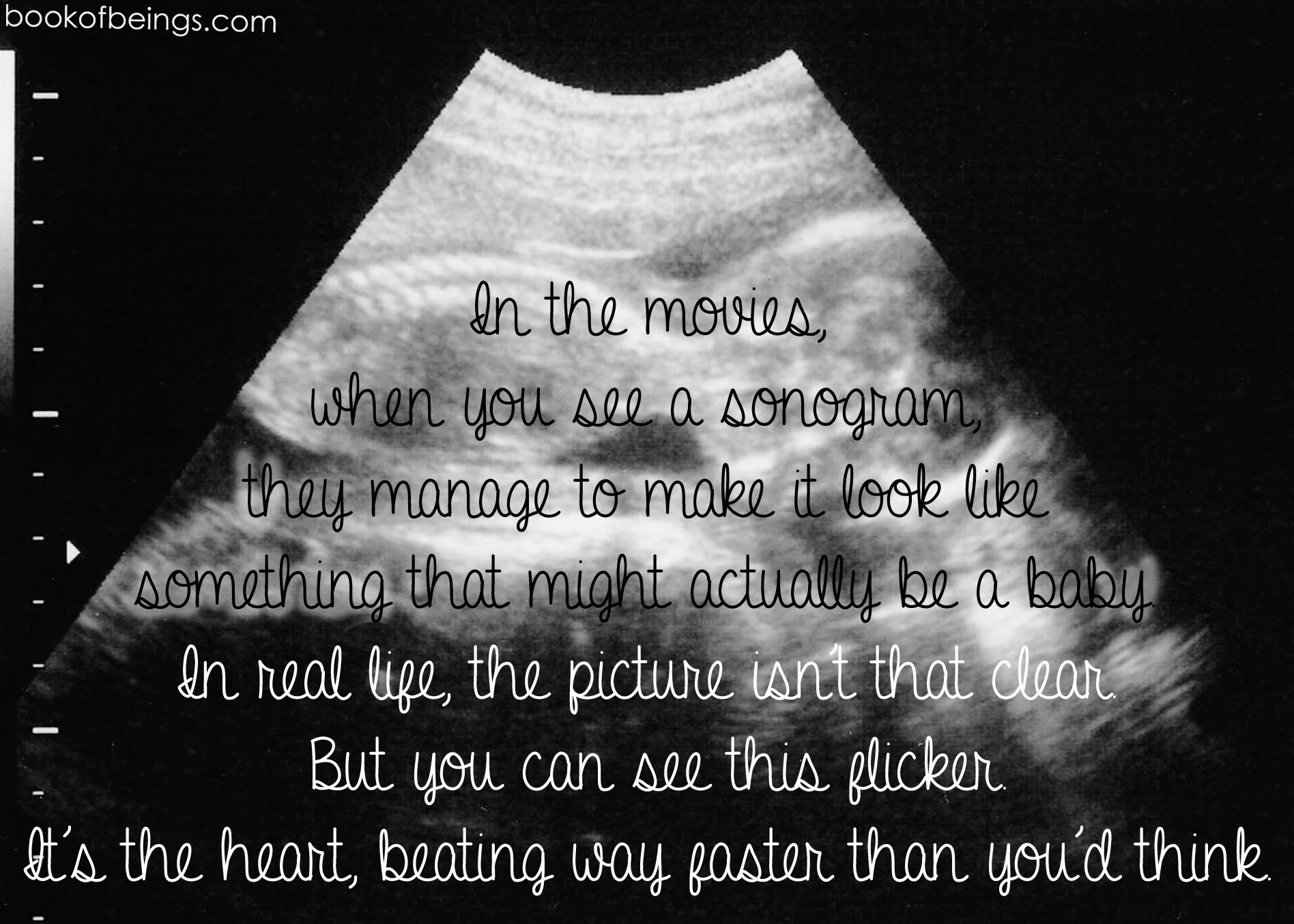 from Chapter 15 In the movies, when you see a sonogram, they manage to make it look like something that might actually be a baby. In real life, the picture isn't that clear. But you can see this flicker. It's the heart, beating way faster than you'd think. The Book of Beings Read-Along at bookofbeings.com 