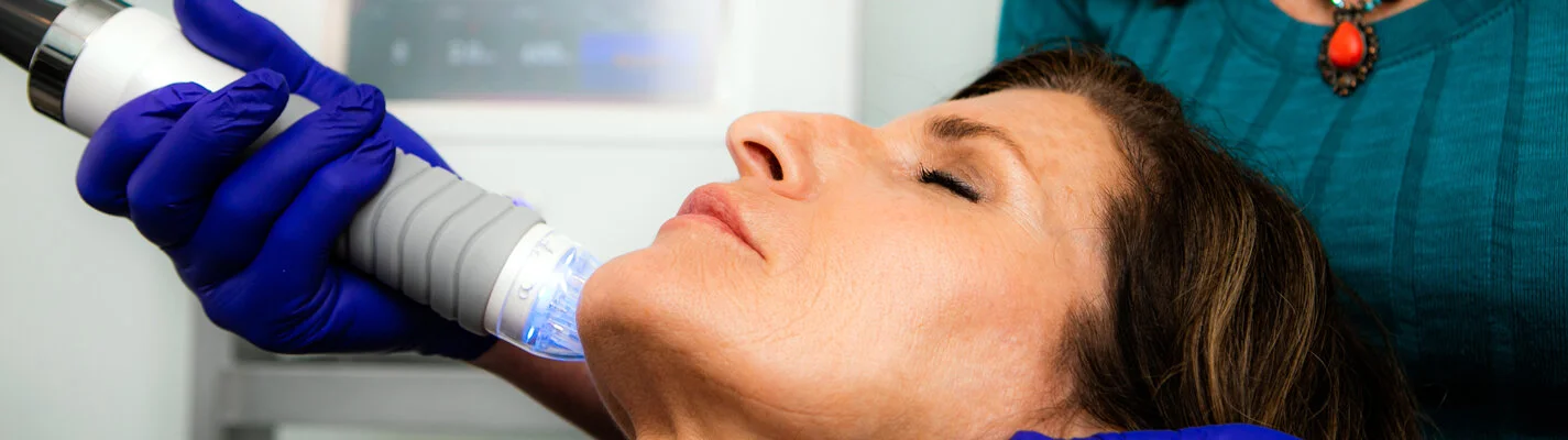 microneedling_banner.jpg
