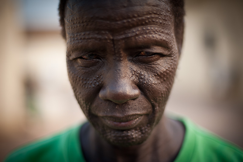 Thomas and his tribal scars, Bentiu.