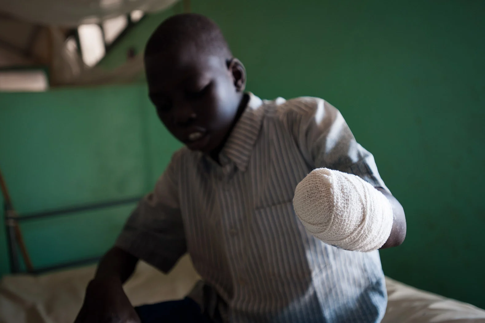 Jacomo Tia Jibril (4) lost his hand and half of his forearm as a result of the bombing of his village of Kurchi by Sudanese Armed Forces fifteen days previously. He was washing clothes at the only borehole in the village when the bombing occurred. After fleeing from the sound of the aircraft, Jacomo says "immediately after, I found my hand hanging off", which later had to be amputated in the facility.