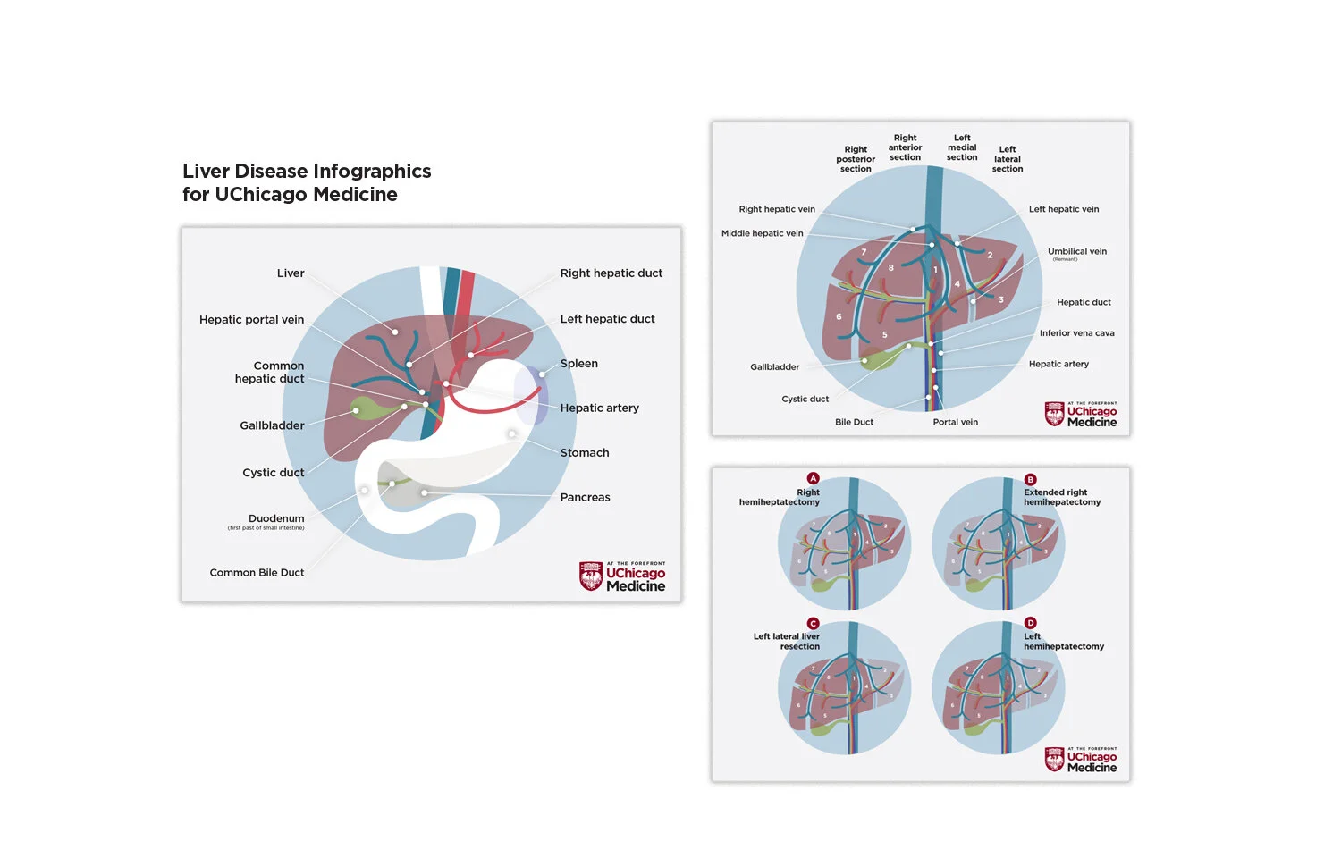 UCM Liver infographics.jpg