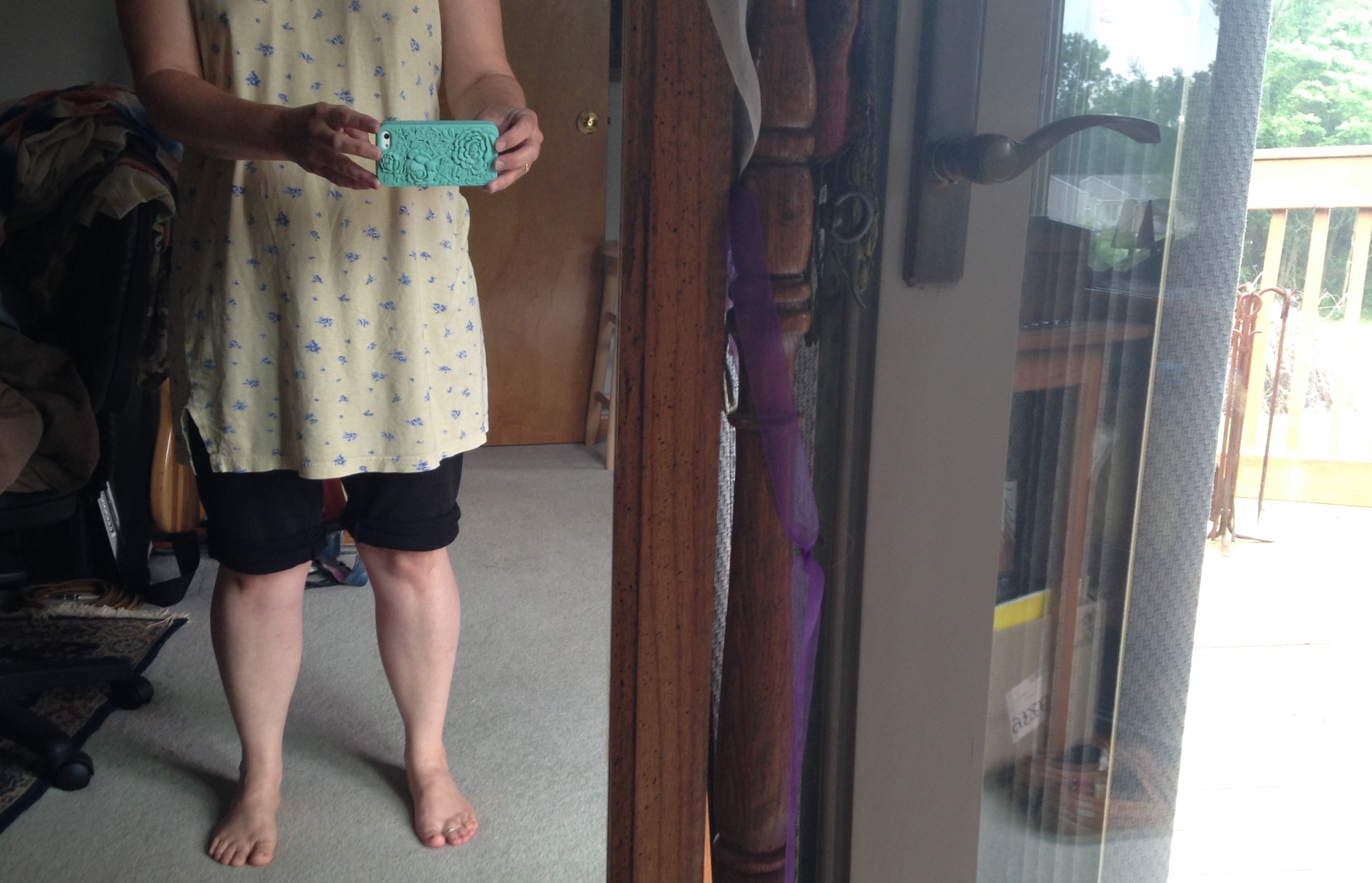 My 'knee selfie'...