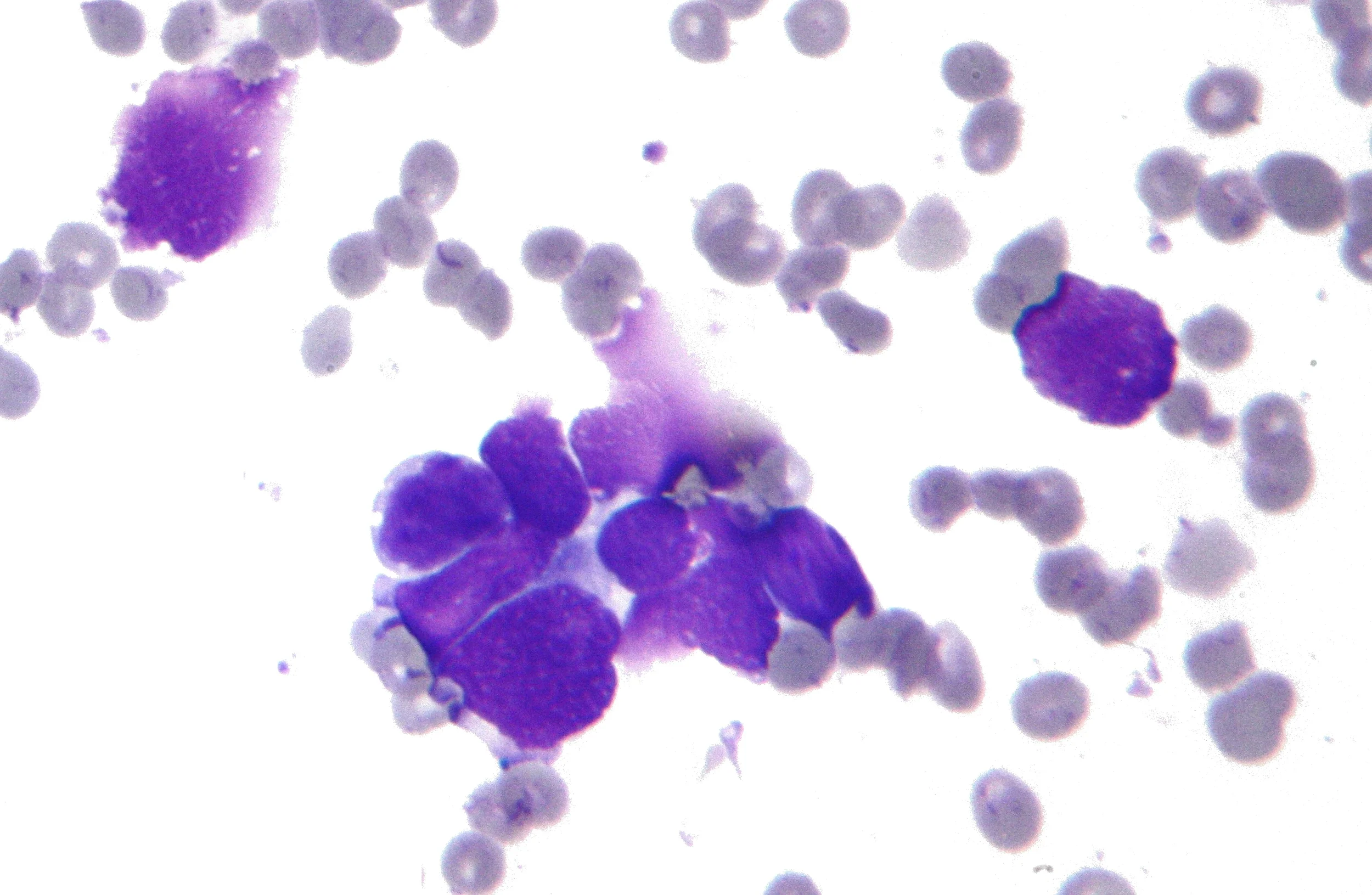 Small lung cancer cells