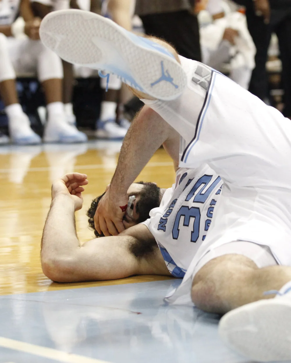 UNC basketball player, Luke Maye, crumbles to the ground bleeding after taking an elbow to the nose.