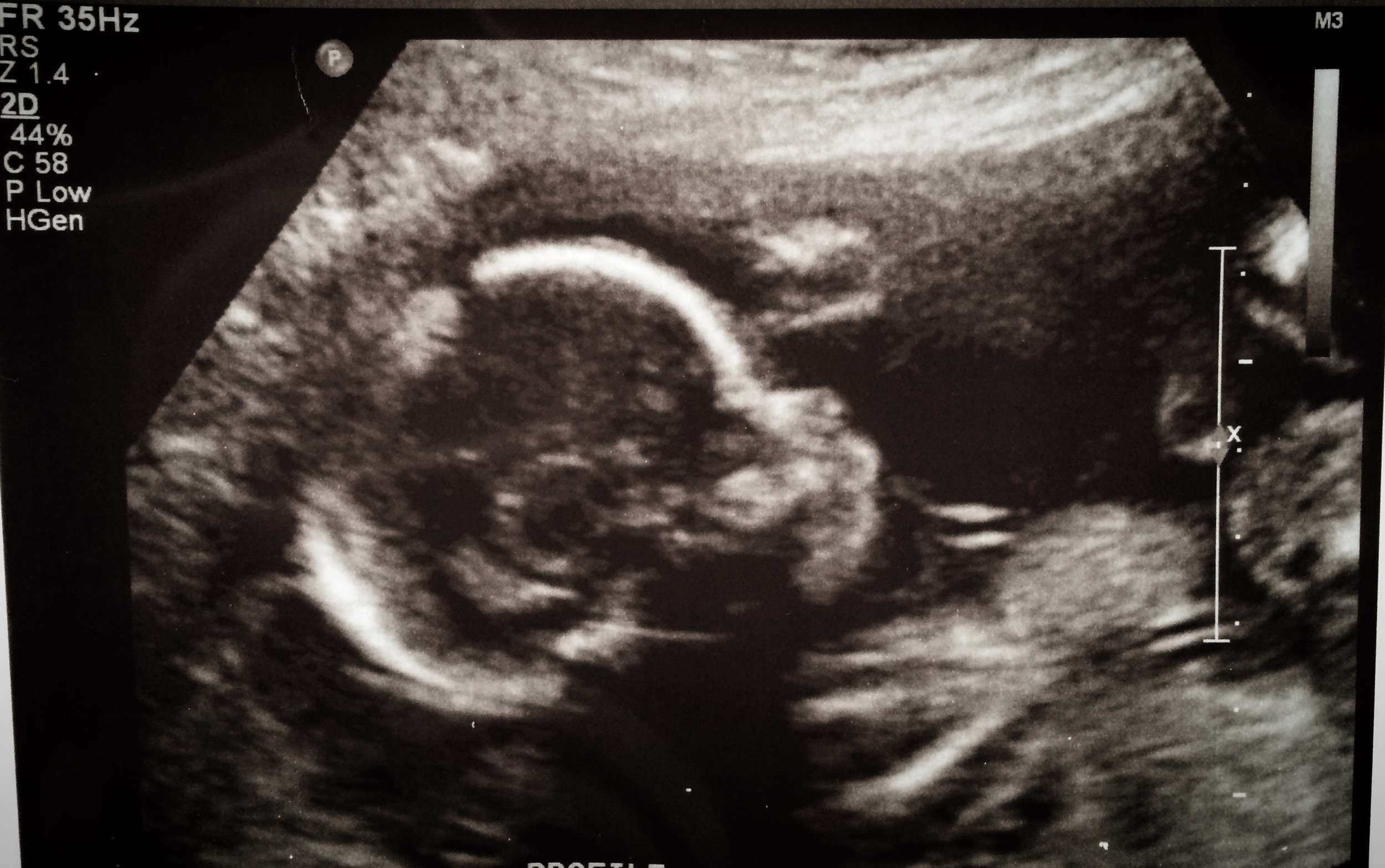 The newest tiny to the Tack Family, due September 2016