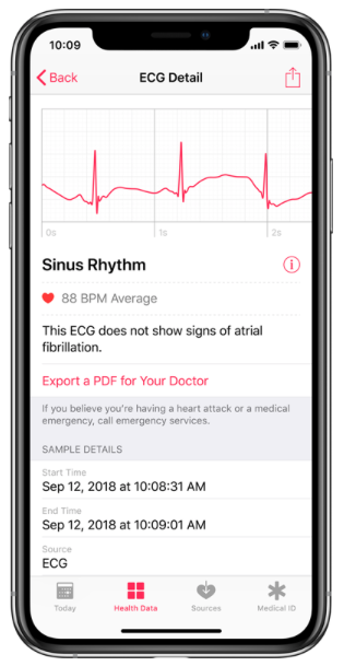 AppleWatch ECG.png