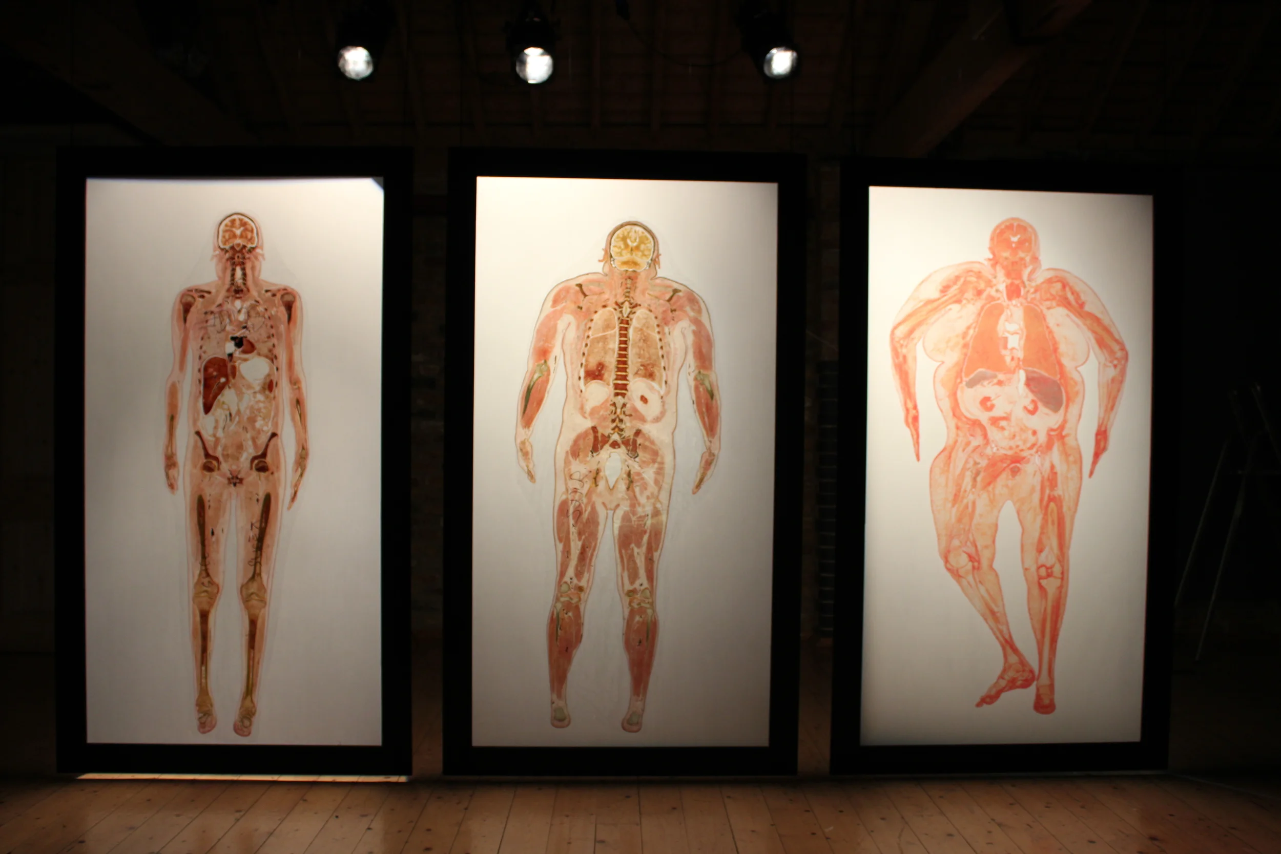 Supersize Vs. Superskinny