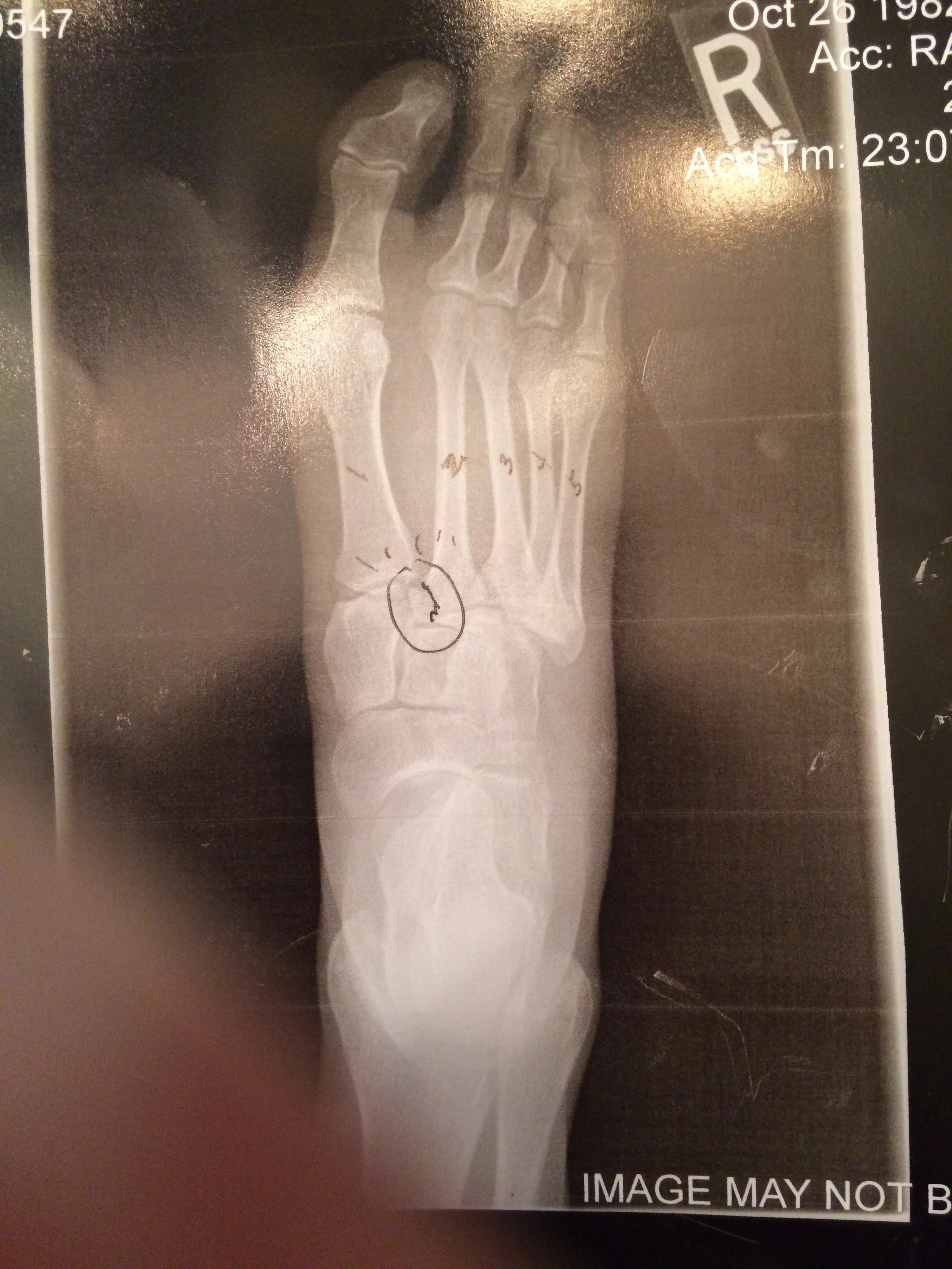 Adventures in Longboarding