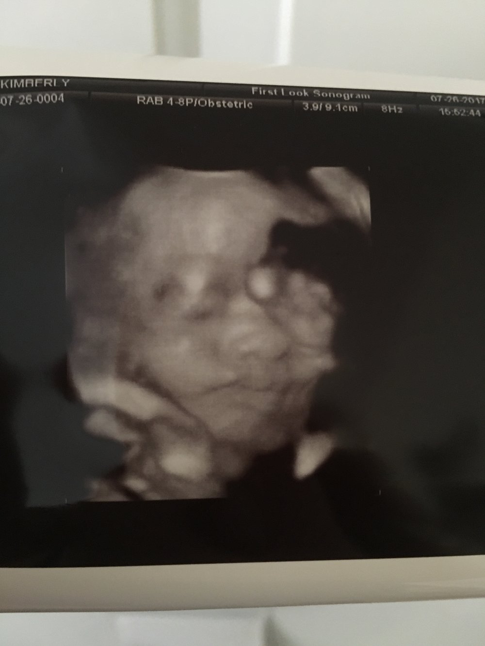  Image from our 4D ultrasound at 31 weeks.&nbsp; 
