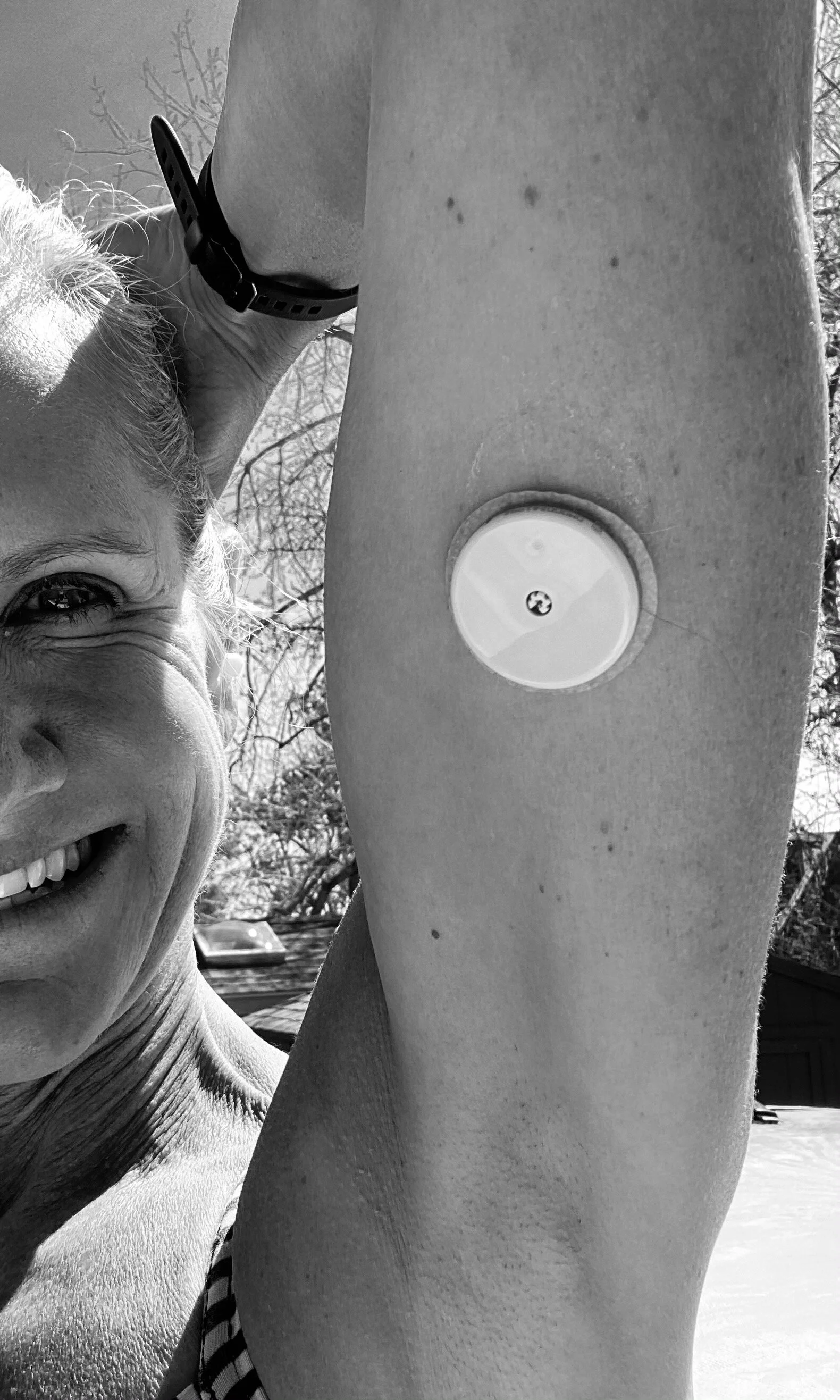 My Continuous Glucose Monitor Experiment