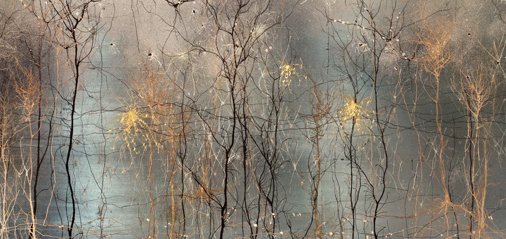 A foto acima, é um trabalho de dois neurocientistas, ©Greg Dunn & Will Drinker, Sendo também artistas plásticos eles aproveitaram imagens produzidas por tecnologia de ponta para enriquecerem com pó de ouro. O que vemos, é um ínfimo instante de neurônios em movimento. 