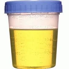 This urine sample has a lid.