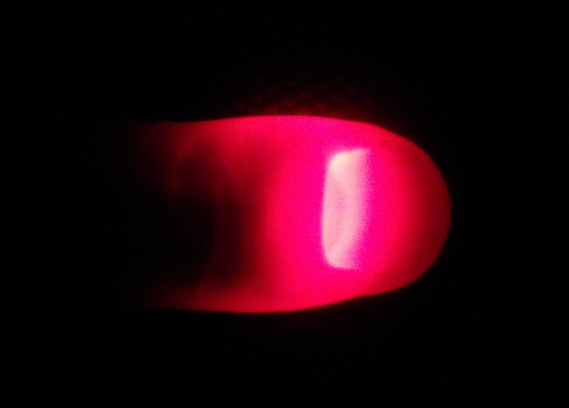 Photo of LED light from phone penetrating through thumb. Photo and thumb by author.
