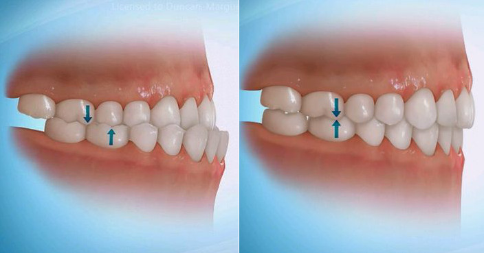 first bite dental first bite dental
