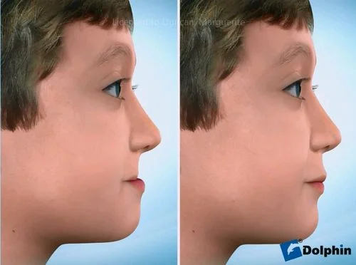 When should your child be seen by an Orthodontist?