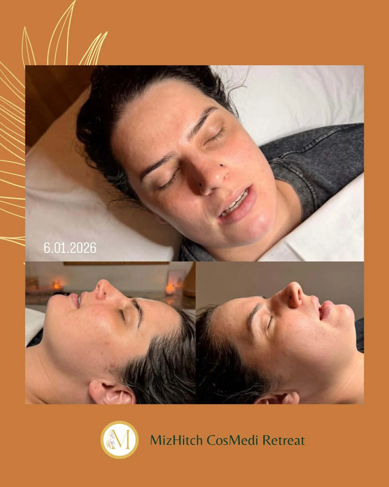 When results keep result-ing 💫

This is why we don&rsquo;t stop with before/after or then/now&hellip;a skin journey is about skin health and it&rsquo;s progress - not the hype.

Your skin deserves its own plan - see us for your next Skin Consultatio