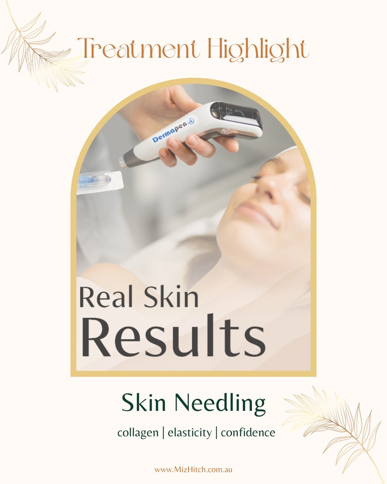 Real skin results don&rsquo;t come from trends. They come from understanding - let our knowledge guide your skin journey.

Skin needling works by stimulating the skin&rsquo;s own repair mechanisms - encouraging collagen and elastin production while s