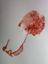 placenta 3.JPG