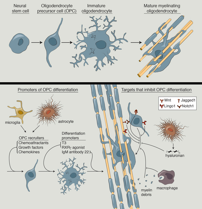 Remyelination and multiple sclerosis: therapeutic approaches and challenges. Hartley MD 1 , Altowaijri G , Bourdette D . 2014 Oct;14(10):485. doi: 10.1007/s11910-014-0485-1.