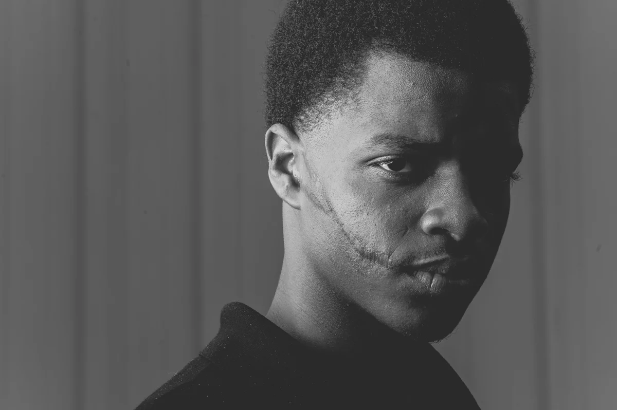 He asked me to take a photo of his scar and said "It's part of me."