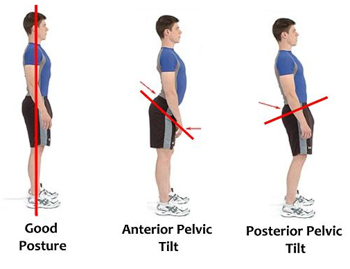 6 Easy Ways To Improve Your Posture — Physio By Design