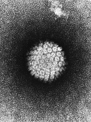 Electron Microscope Image of the Human Papilloma Virus Source: Laboratory of Tumor Virus Biology