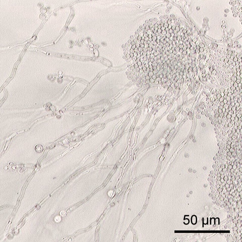 Candida_albicans.jpg