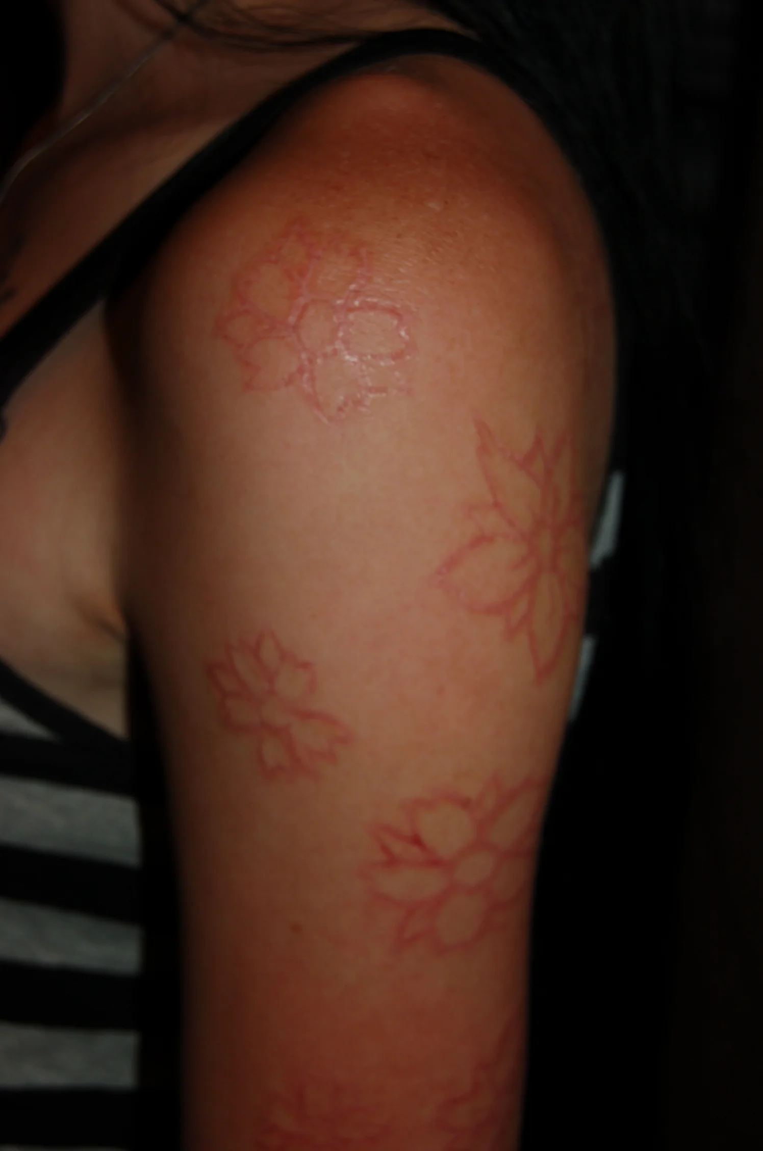 Scarification by Steve Truitt — Ascension Body Mod