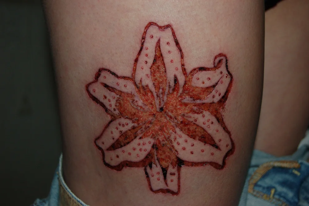 Flower Scarification Healed