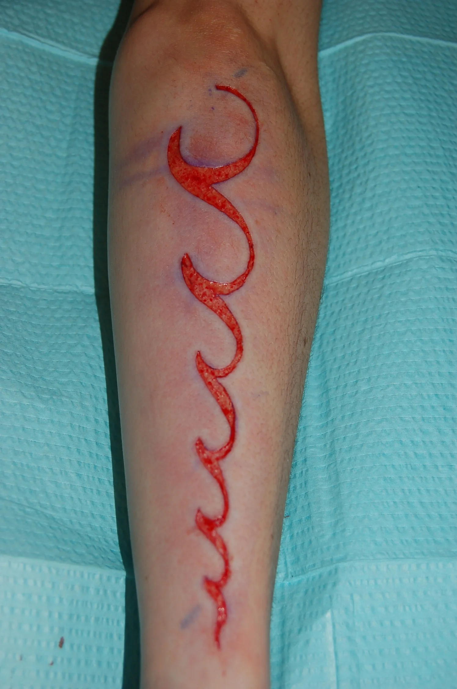 kristinarm (3).JPG
