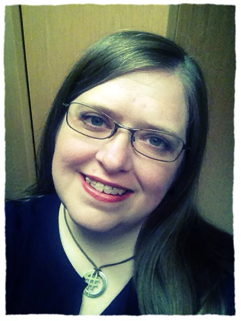 Post oral surgery - much, MUCH better than after the accident (I did not take pictures of that), but I miss my pre-accident teeth a lot. Those aren't braces - it's wire and glue holding my teeth in place. Nice, eh? 
