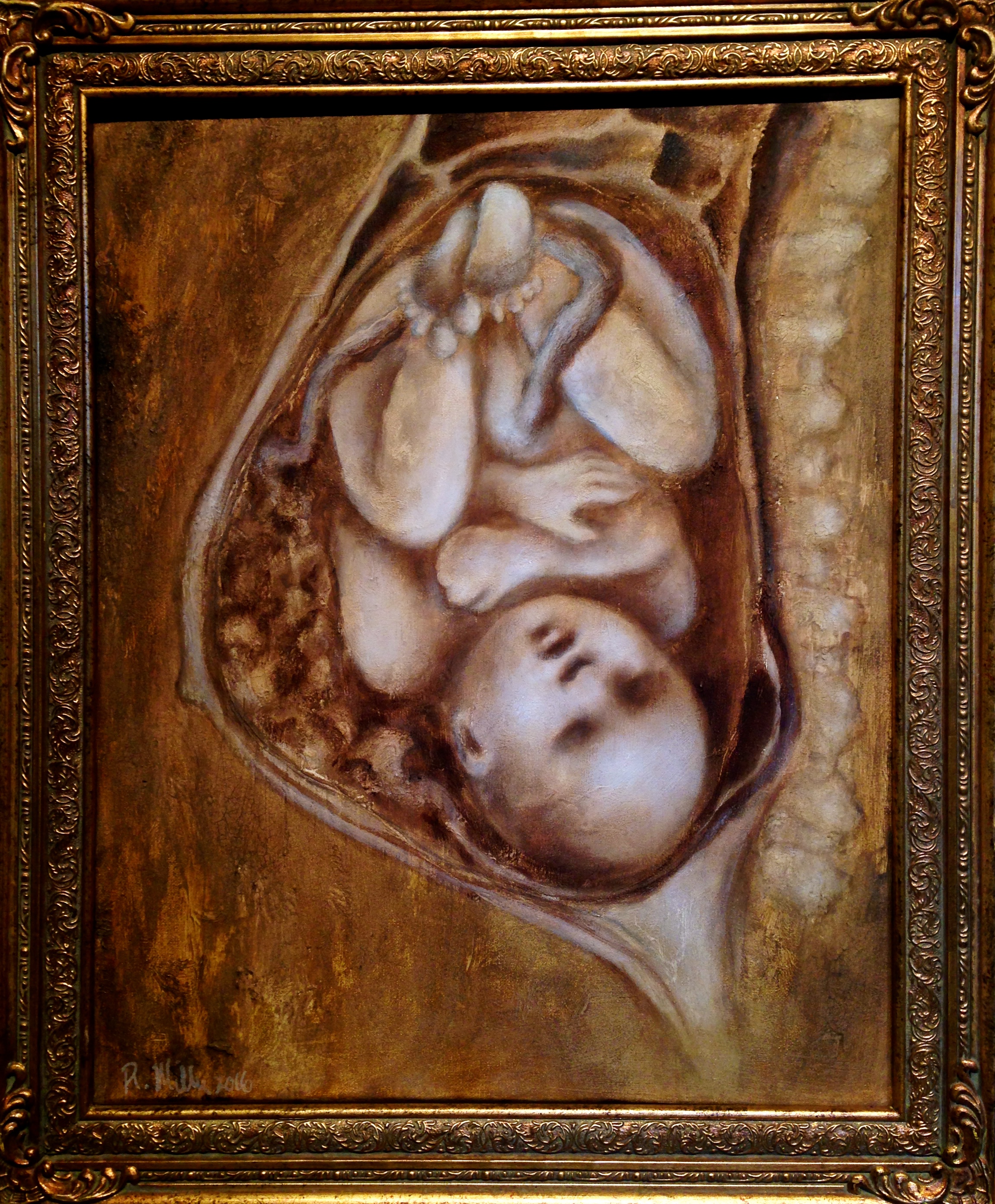 (framed)Artnatomy III Birth, 2016 Mixed media on canvas