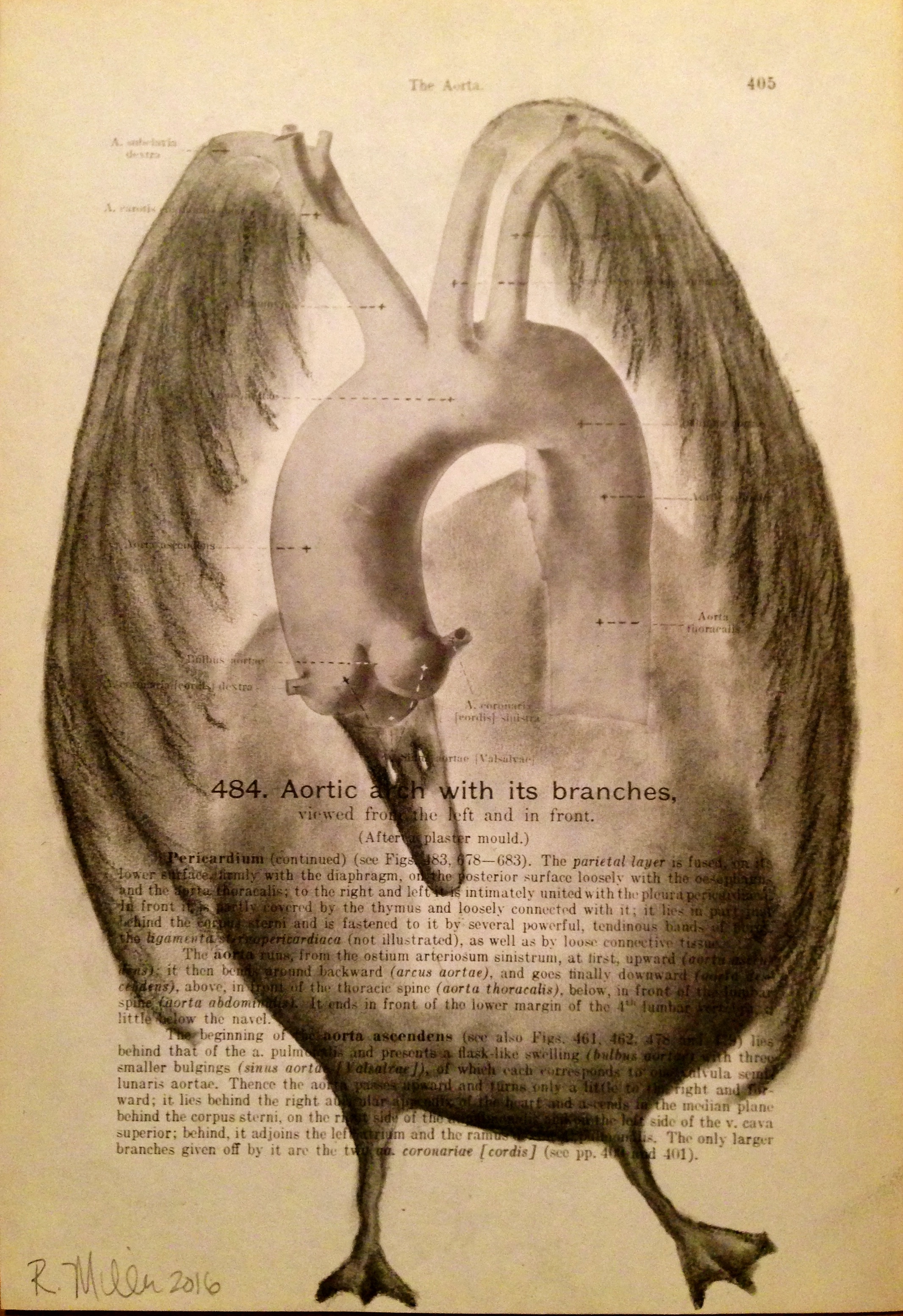 Aortic Bird, 2016 Charcoal on antique medical paper