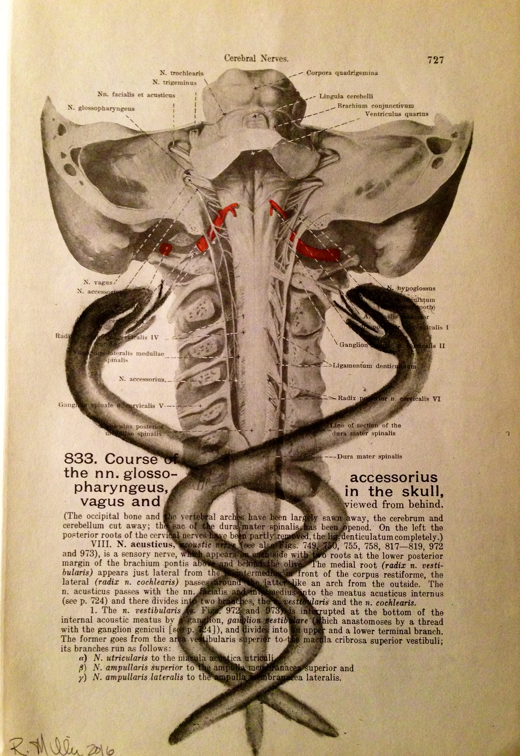 Cerebral Constriction, 2016Charcoal on antique medical paper