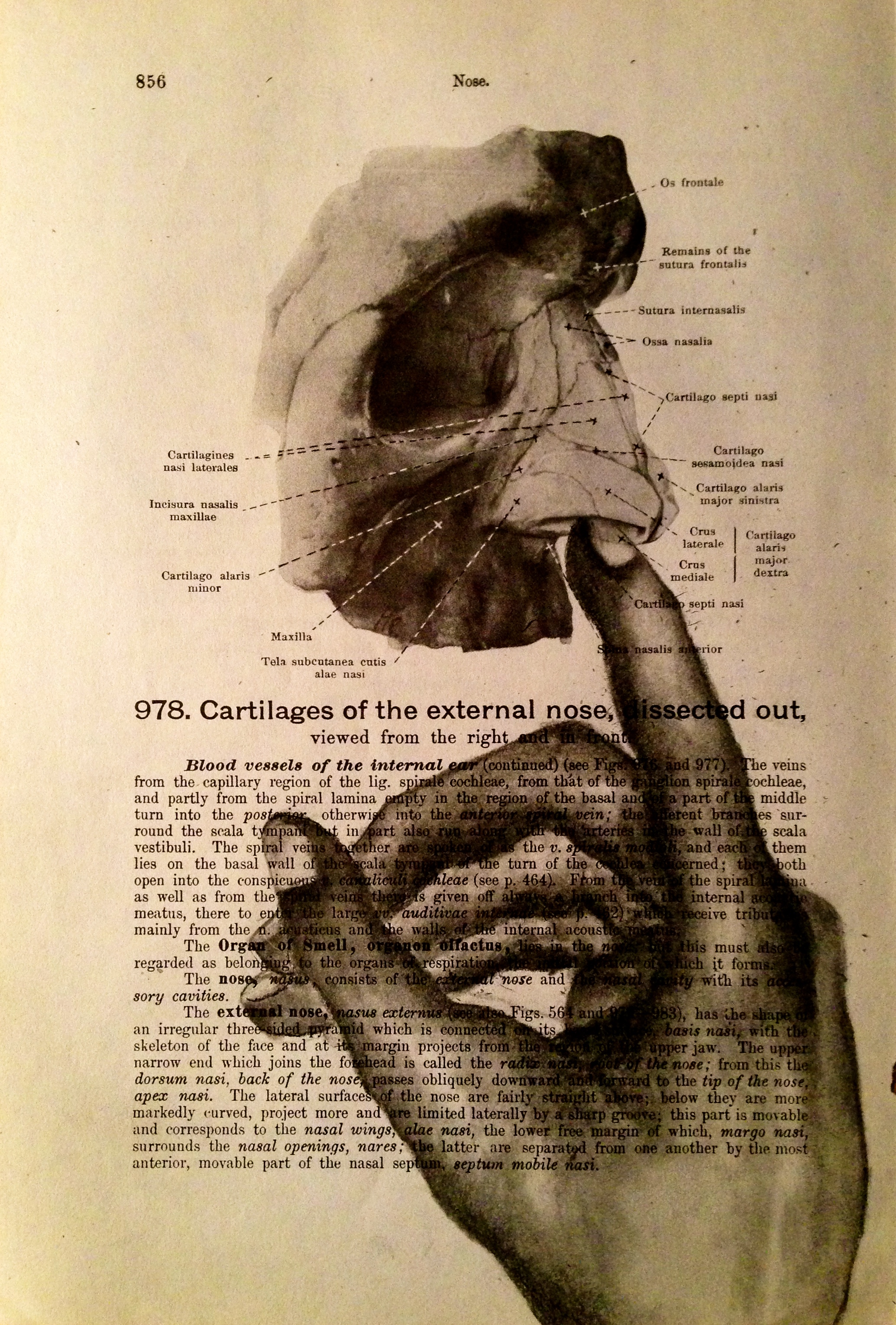 No Brainer, 2016 Charcoal on antique medical paper