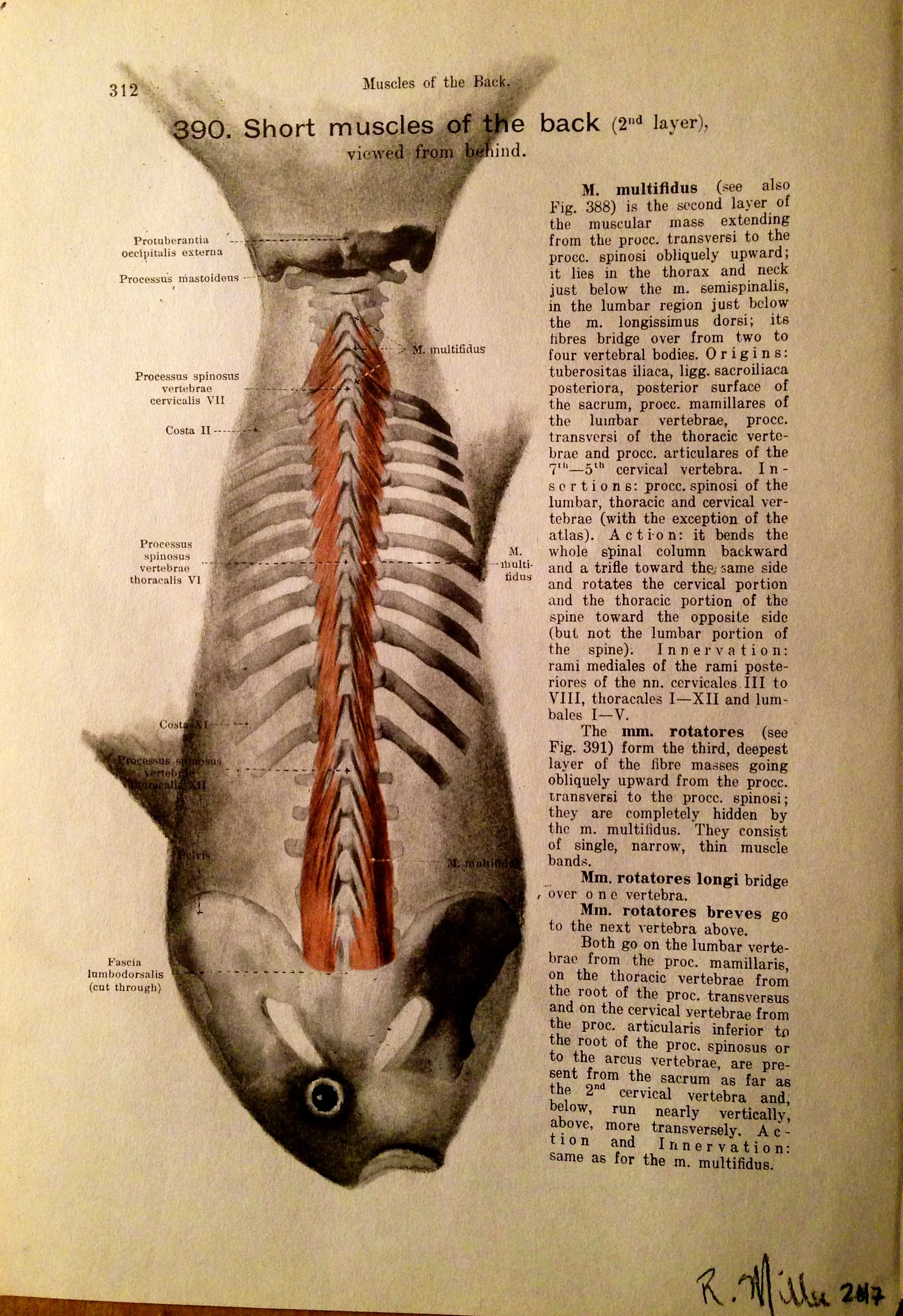 Pelvis Head Trout, 2017Charcoal on antique medical paper