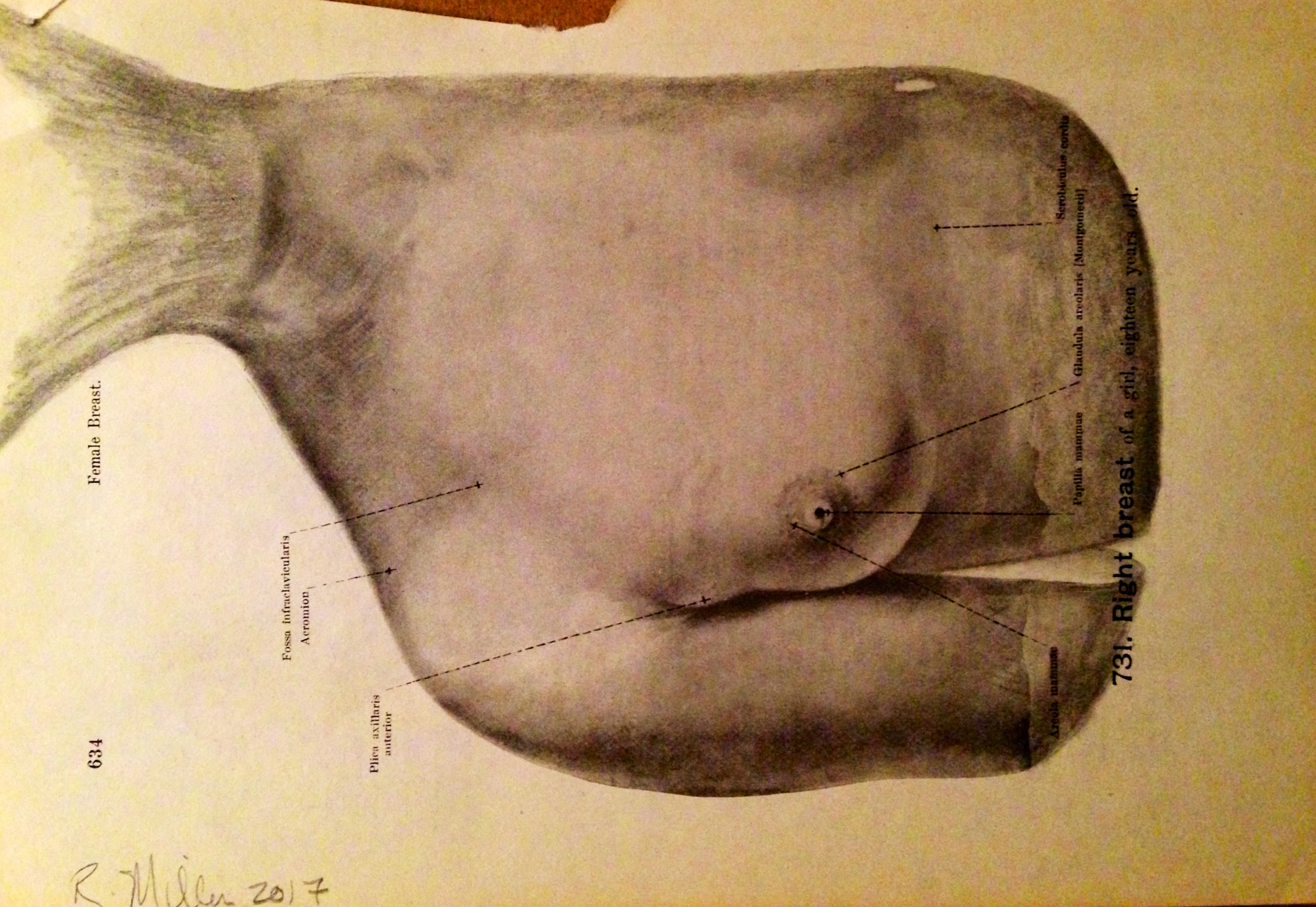 Melon-Headed Whale, 2017 Charcoal on antique medical paper