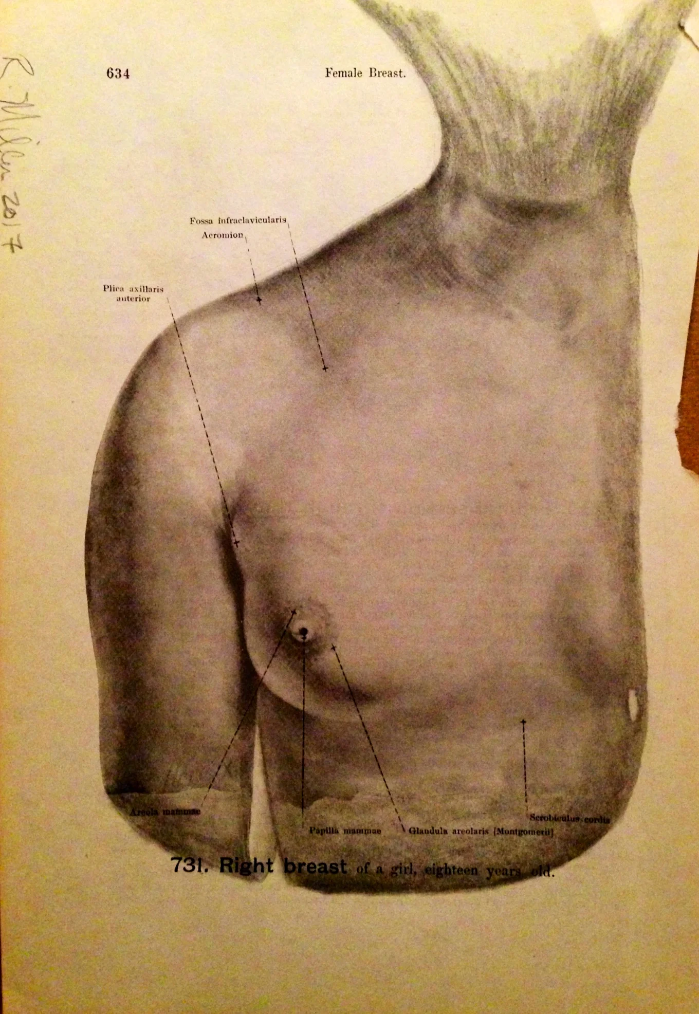 Melon-Headed Whale, 2017 another perspectiveCharcoal on antique medical paper