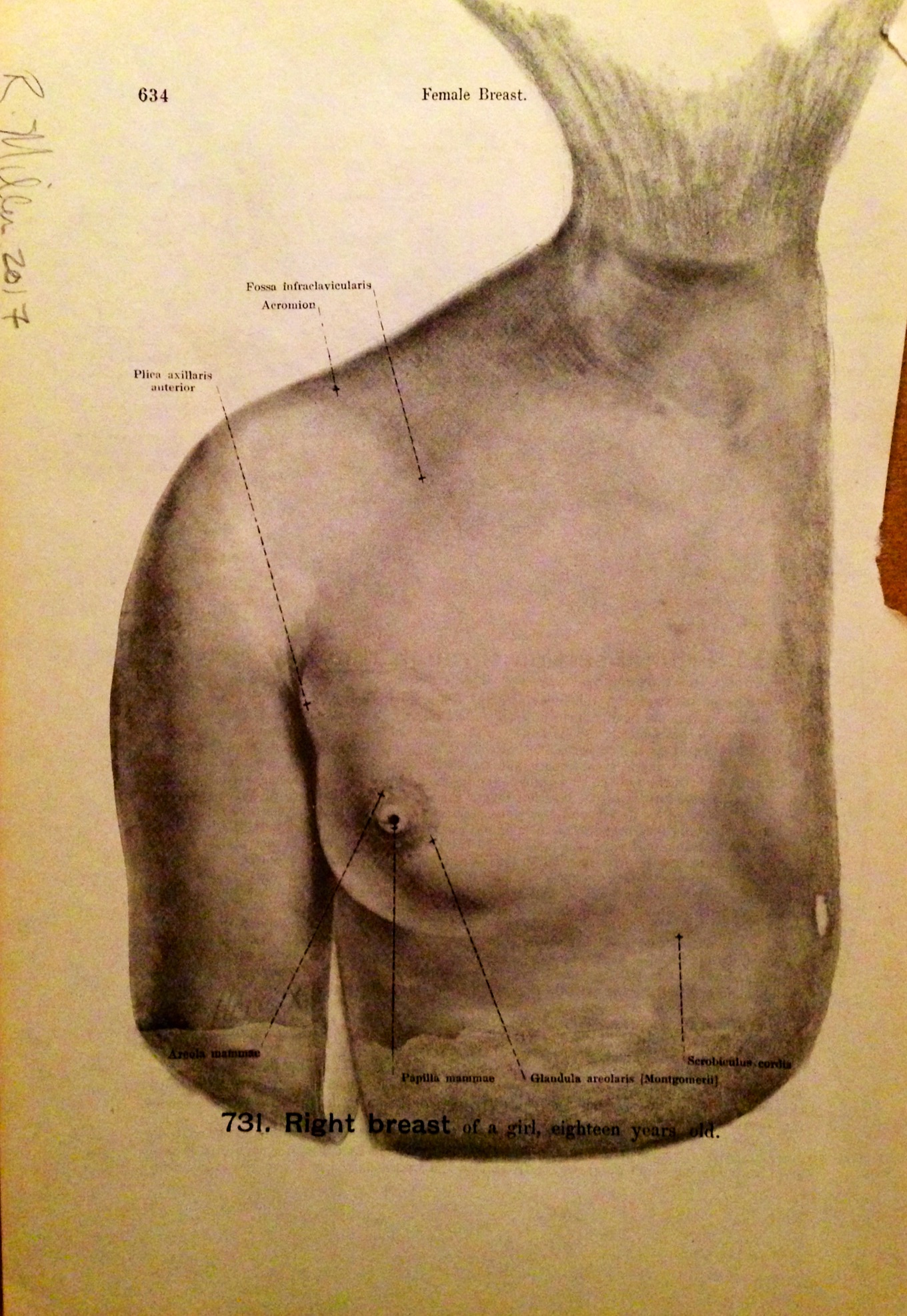 Melon-Headed Whale, 2017 another perspective Charcoal on antique medical paper