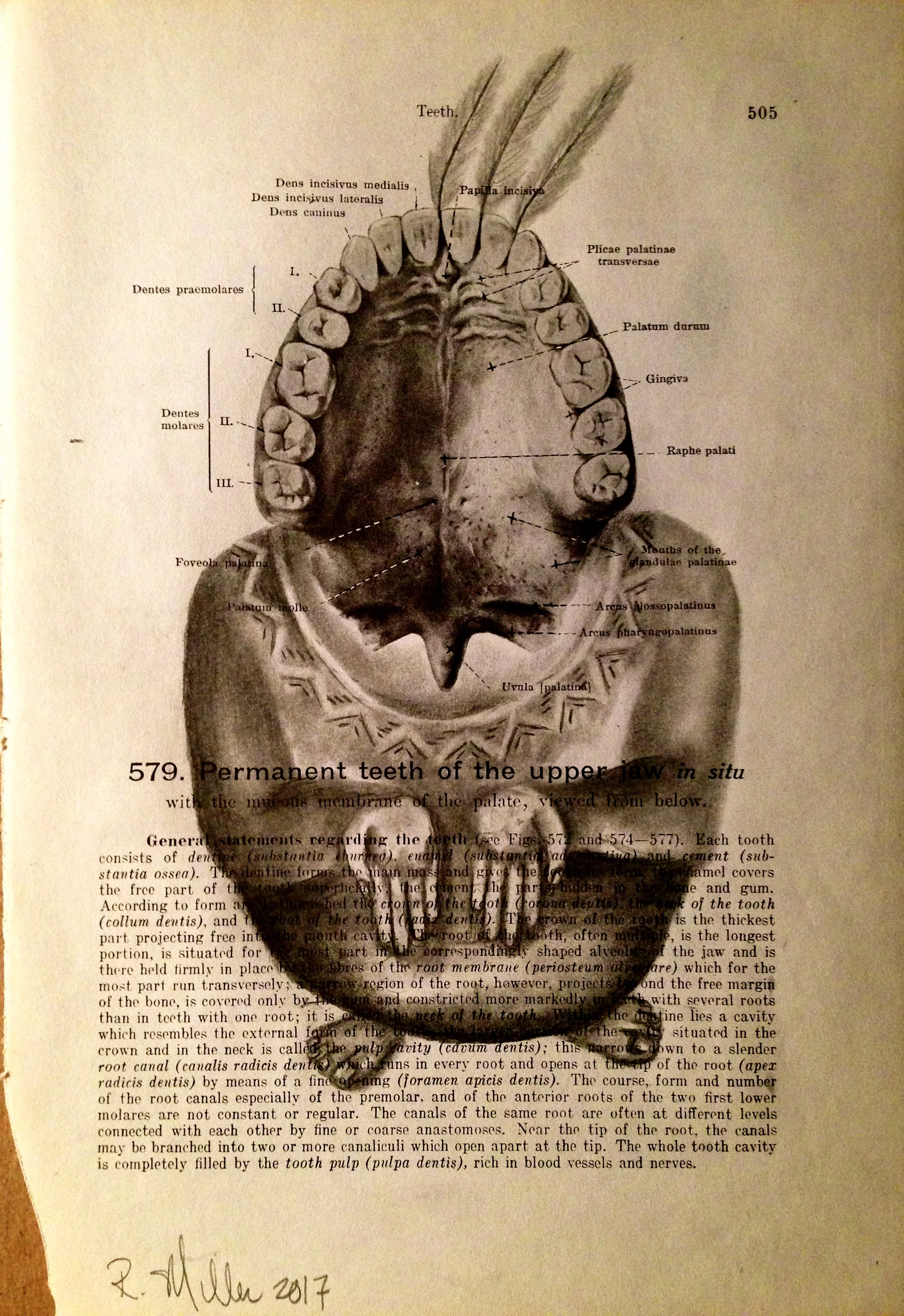 Wisdom Teeth, 2017Charcoal on antique medical paper