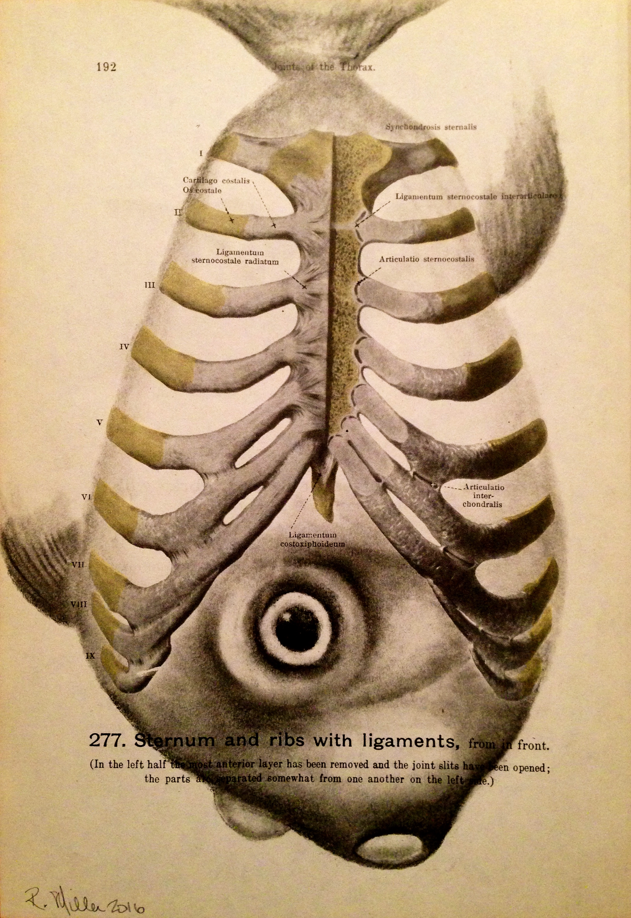 Sternum Fish, 2016 Charcoal on antique medical paper