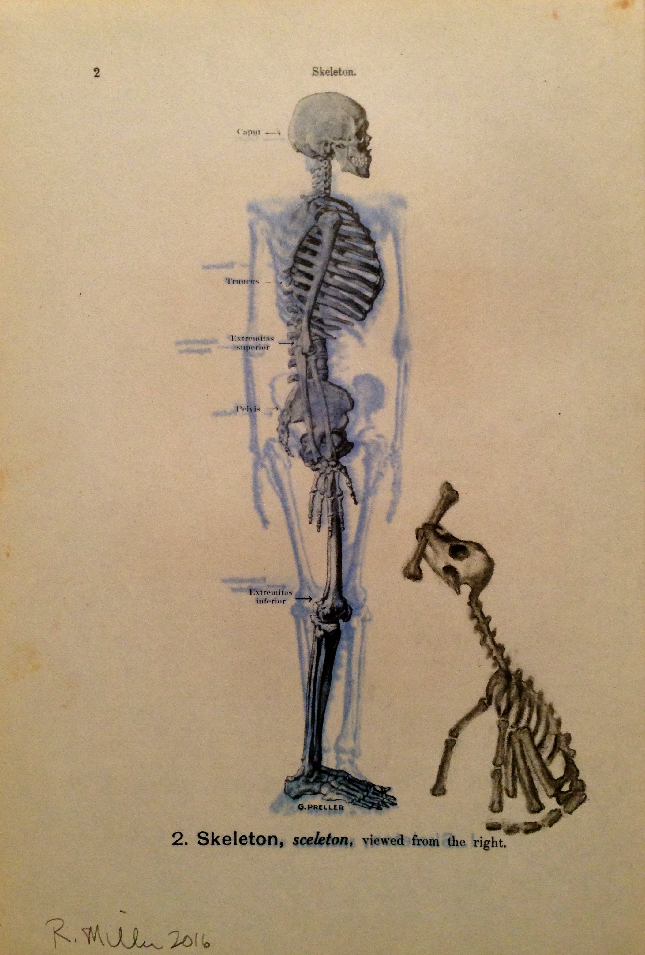 Aortic Bird, 2016 (post spray) Charcoal on antique medical paper