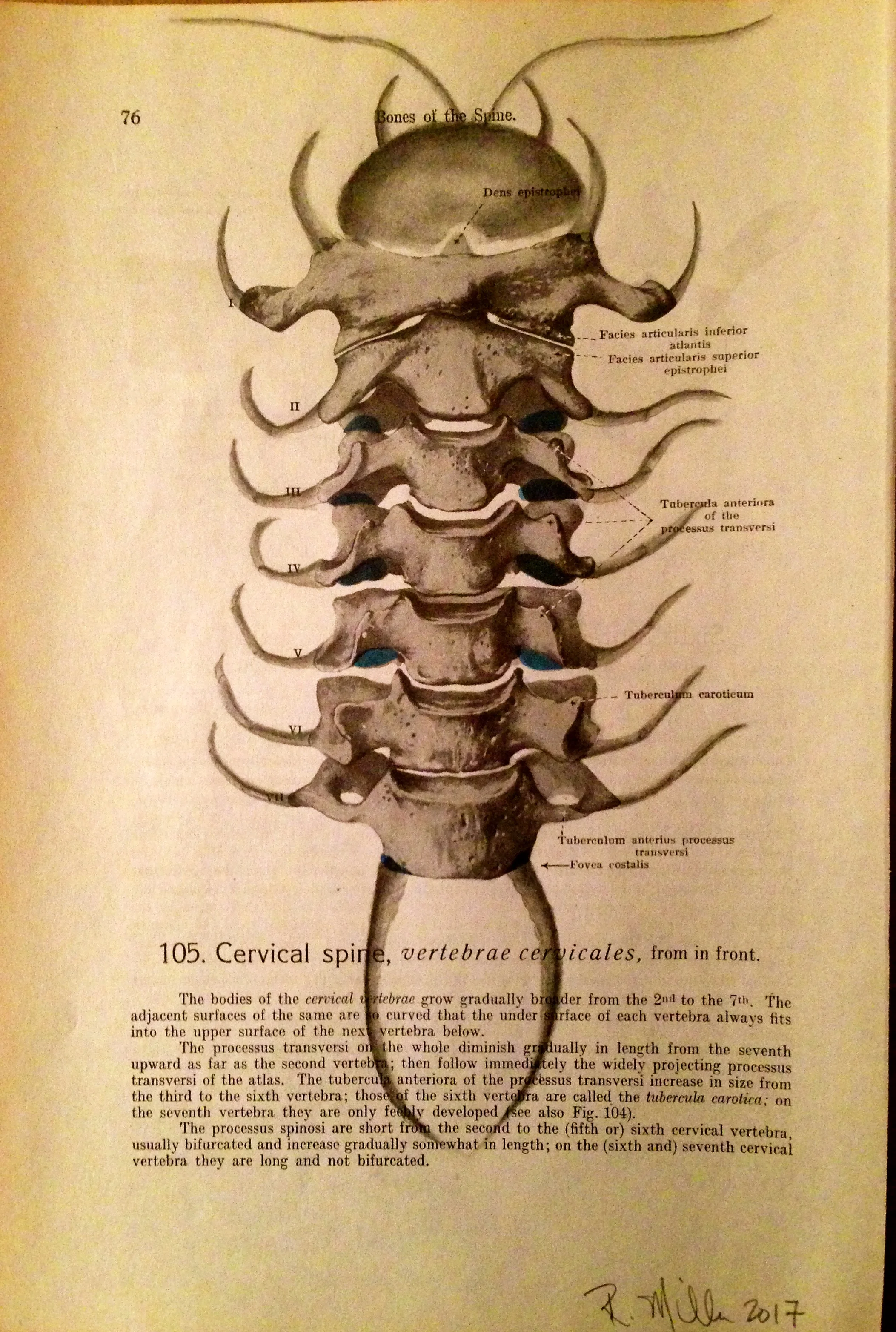 1861 Anatomy paper for Cervical Spine, I see a CentipedeCervical Spineipede, 2017Charcoal on antique 1861 medical paper