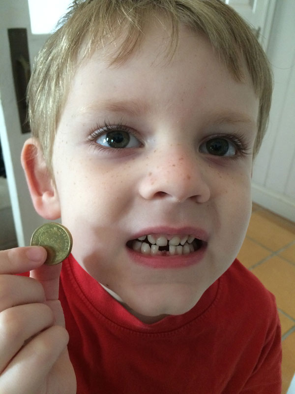 Henry boy lost his first tooth! He was super excited that the tooth fairy didn't forget to put a gold coin under his pillow that night. Silly fairy forgot to put a coin under Lily's pillow the following week... twice! Oops!