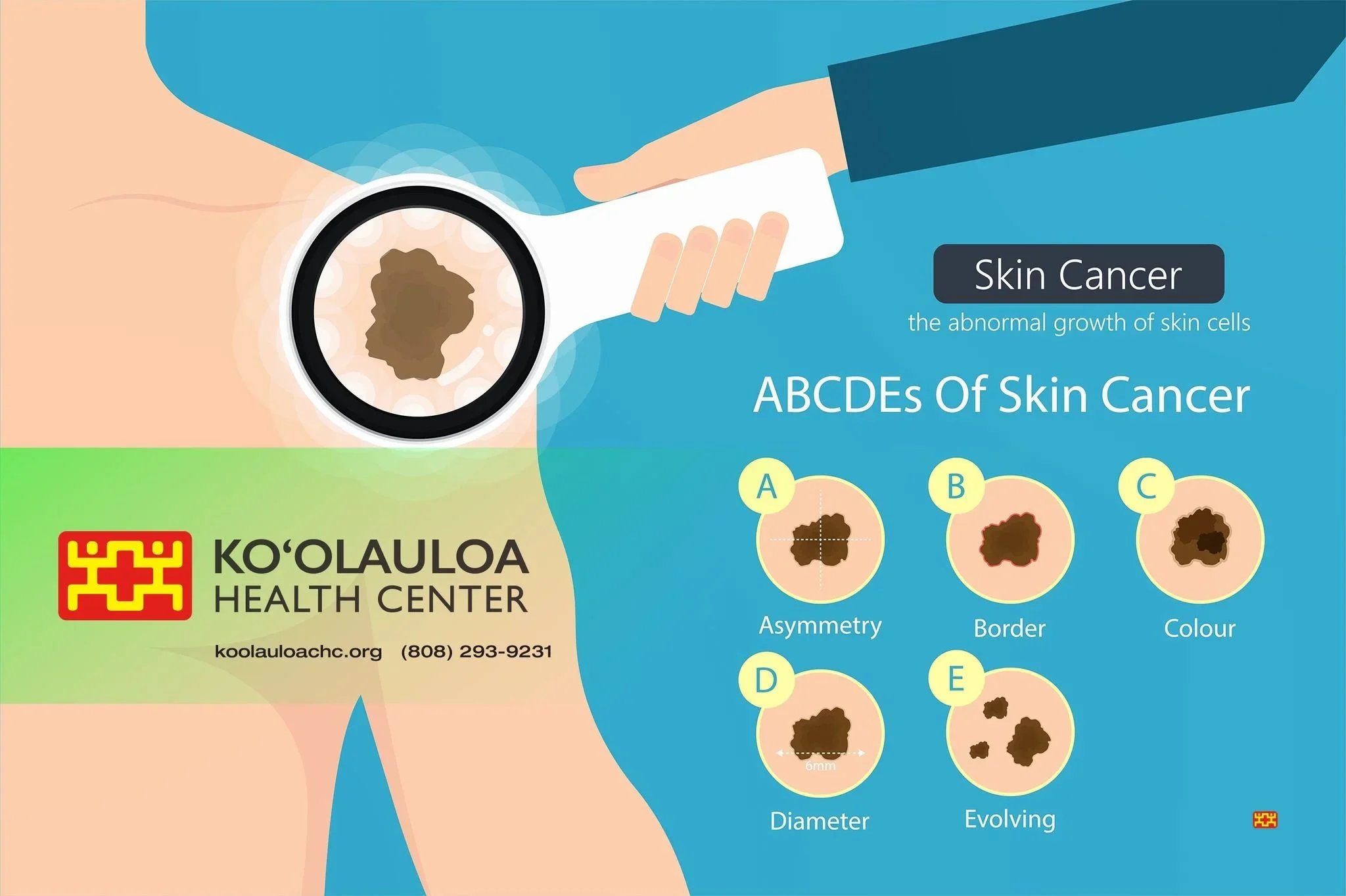 05272025_KHC+Skin+Cancer.jpg.webp
