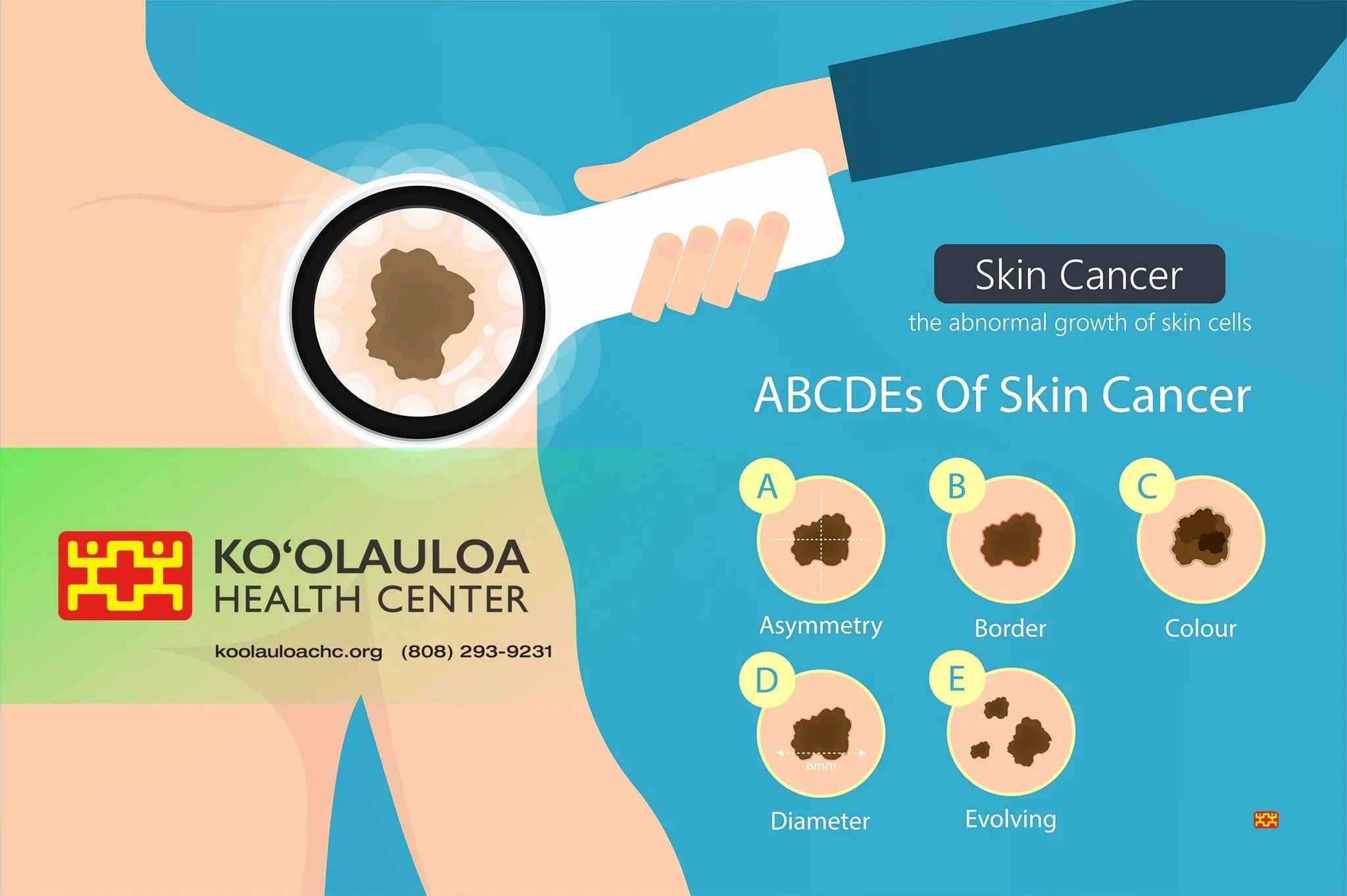 05272025_KHC+Skin+Cancer.jpg.webp