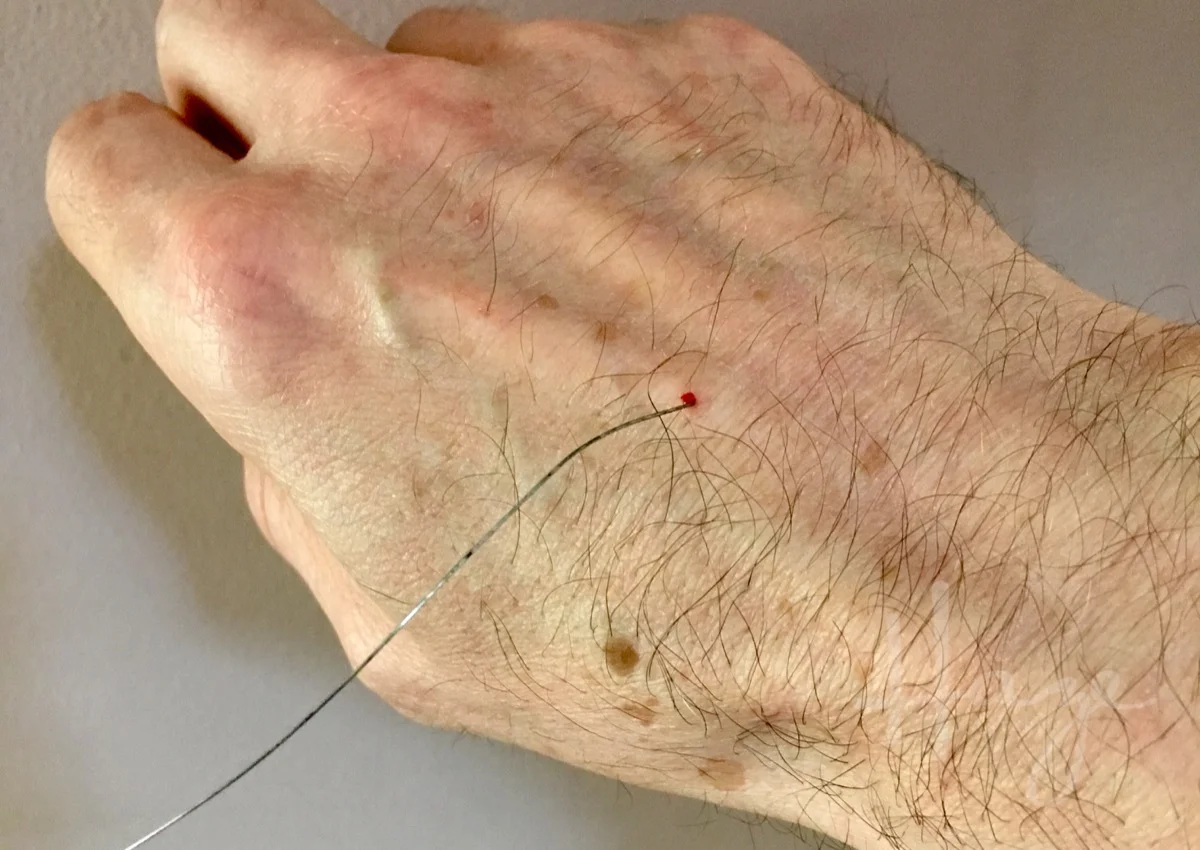 Bizarre guitarrelated freak accident — Haze Guitars