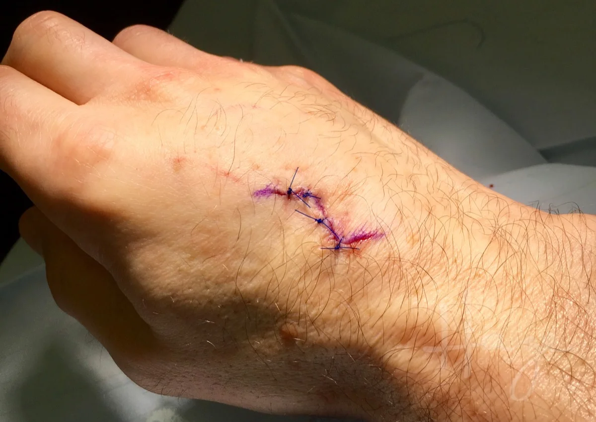 Bizarre guitarrelated freak accident — Haze Guitars