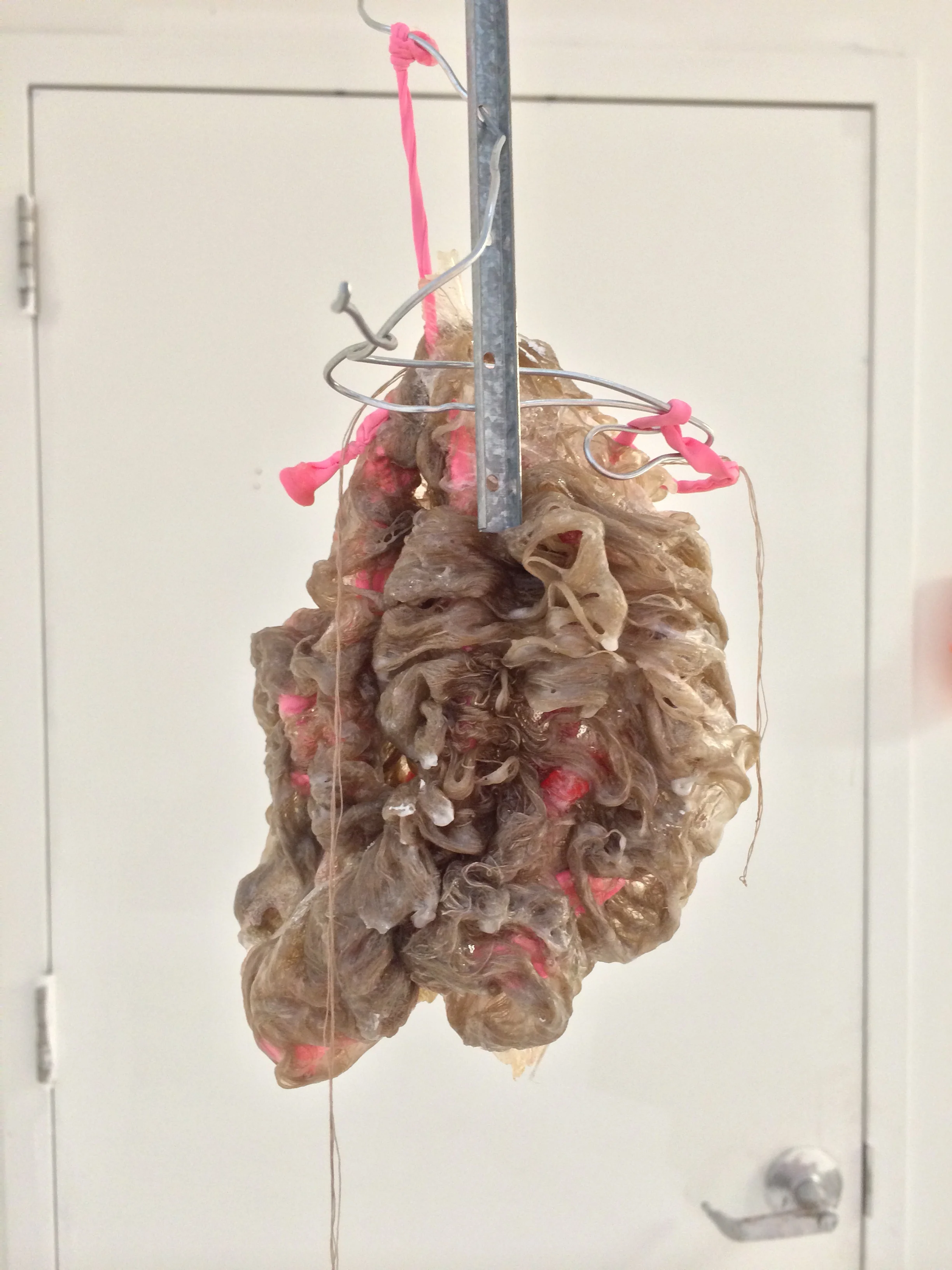 Retroperitoneal (2).JPG