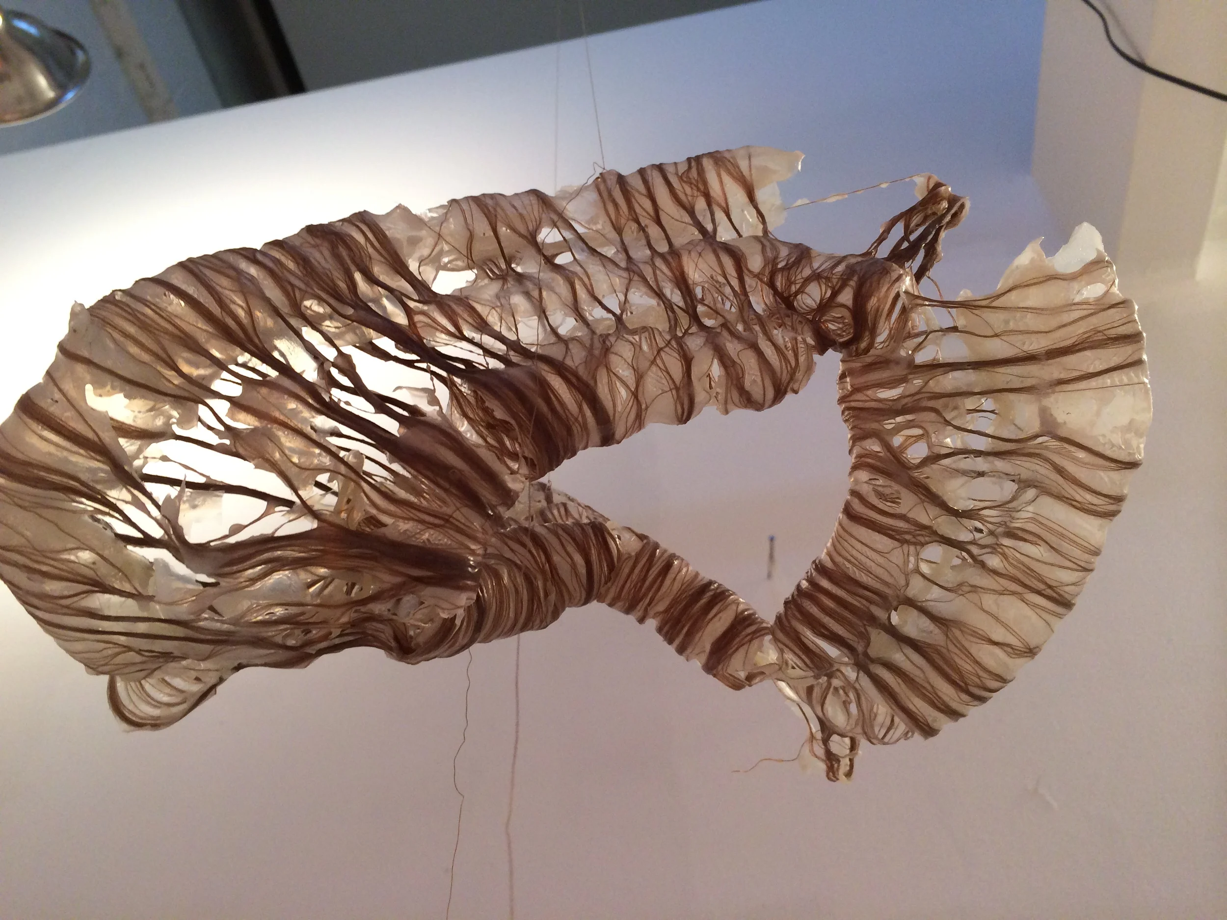 Retroperitoneal 1 (1).JPG